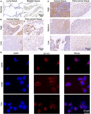 MEK Inhibitor Augments Antitumor Activity of B7-H3-Redirected Bispecific Antibody